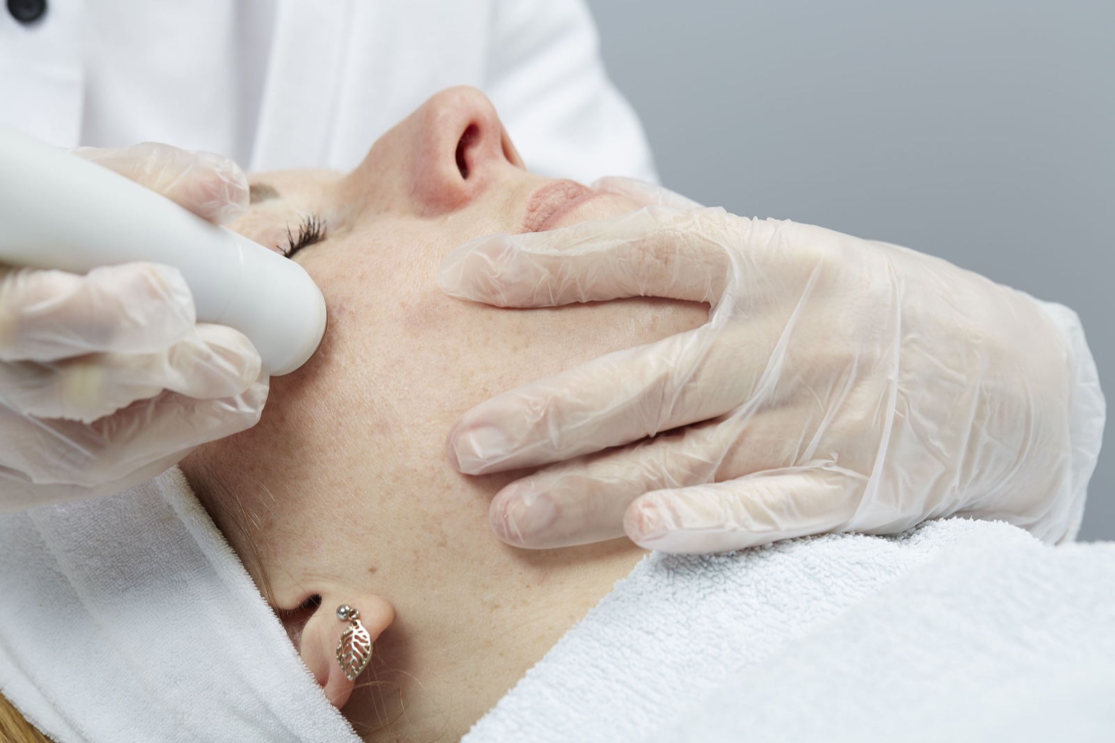 coldPLASMA-Behandlung mit Plasma-Pen bei Lisa Grabinger